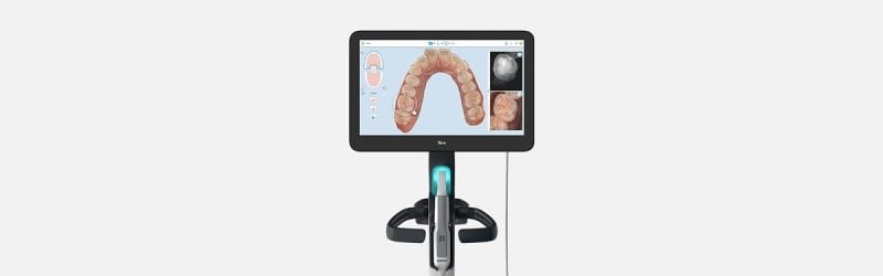 iTero Scanner